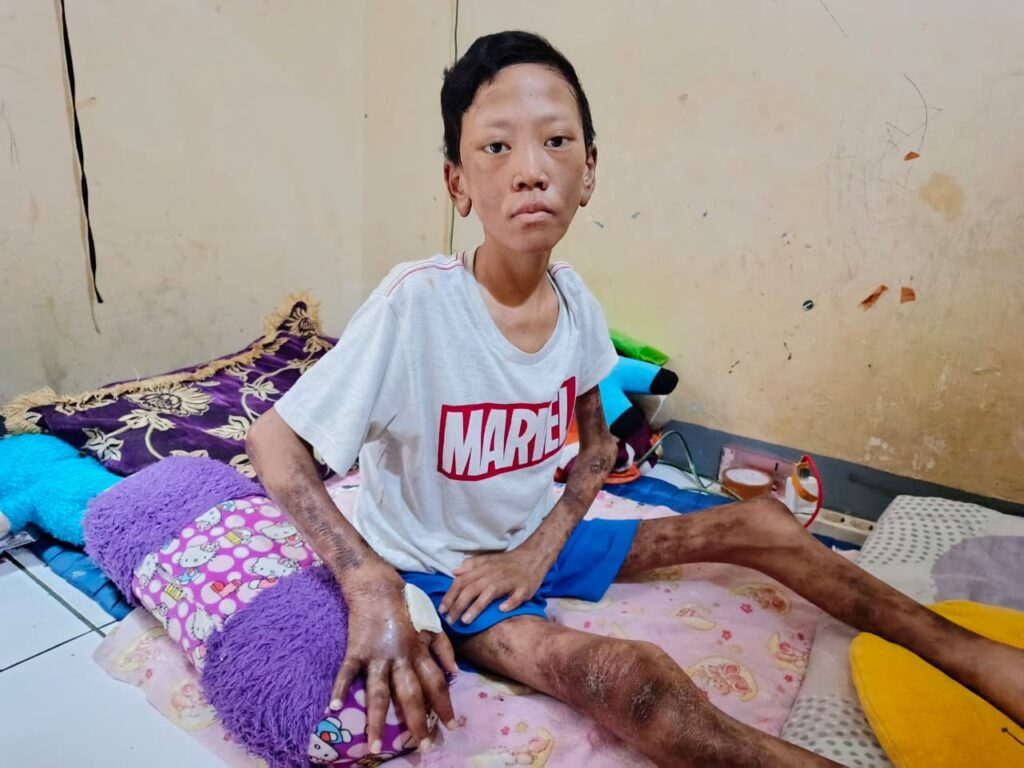 Bantuan biaya pengobatan