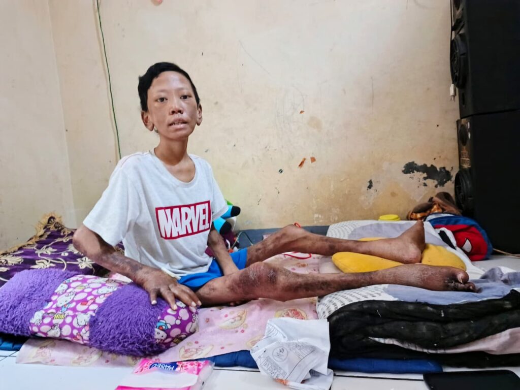 Bantuan biaya pengobatan
