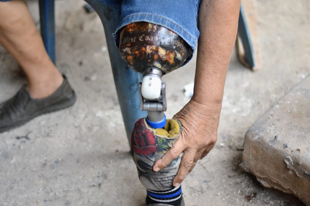 bantuan kaki palsu untuk Apriliya