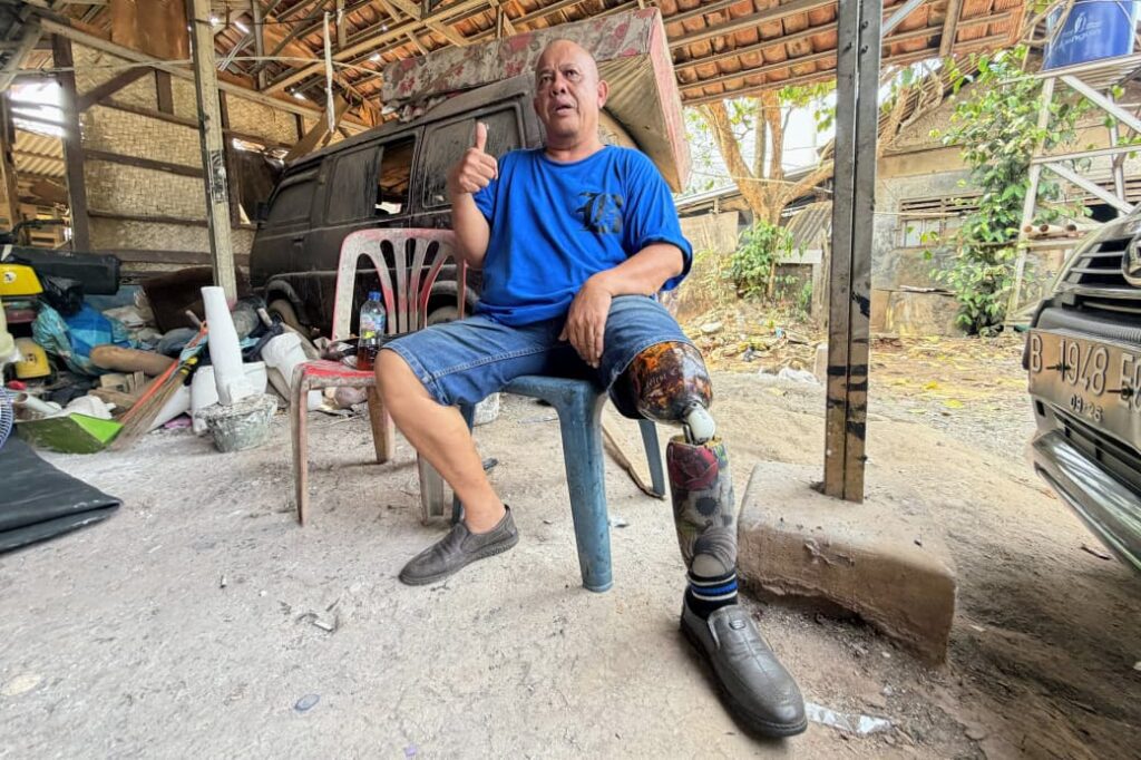 Bantuan kaki palsu untuk Apriliya